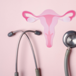 Managing Polycystic Ovary Disorder