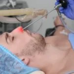 Endoscopic Sinus Surgery: A Safe and Effective Solution for Chronic Sinusitis