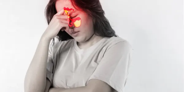bilateral maxillary sinusitis​