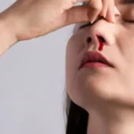 bleeding in nose during summer​