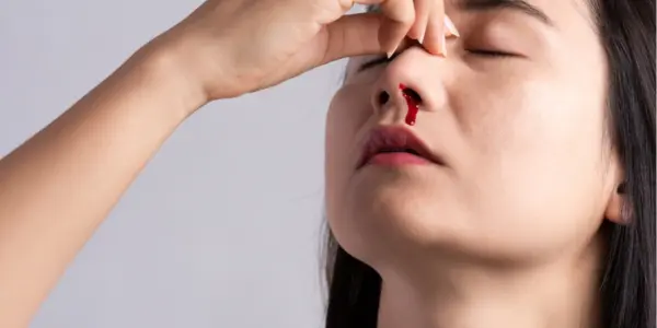 bleeding in nose during summer​