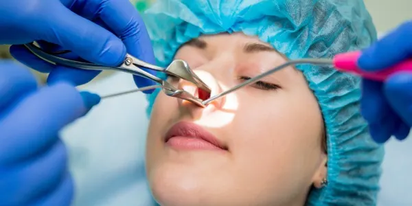 nasal polyps surgery​